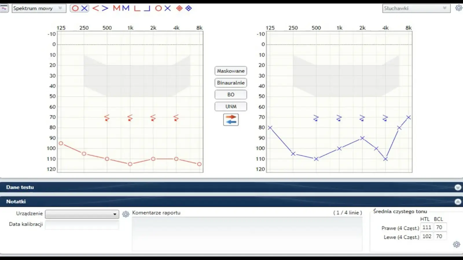 Audiogram z ubytkiem 4 stopnia